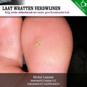 Laat wratten verdwijnen