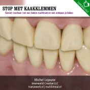 Stop met kaakklemmen